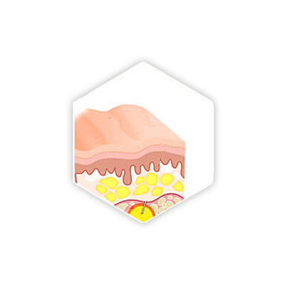 مرحله 4